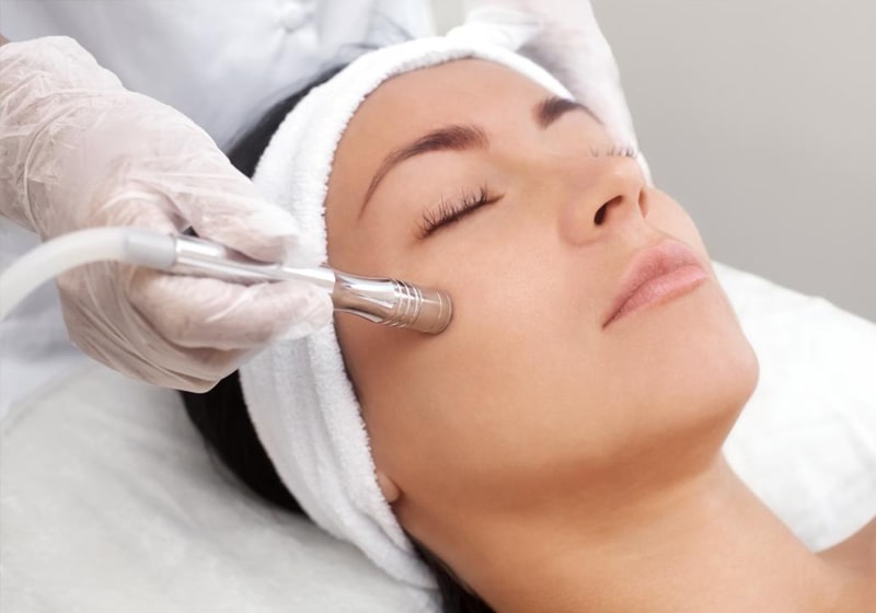 Microdermabrasion5151 00